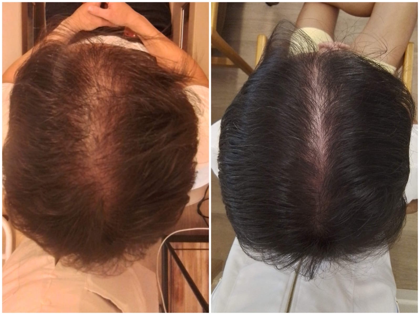 Resultado capilar comparativo de antes e depois 6