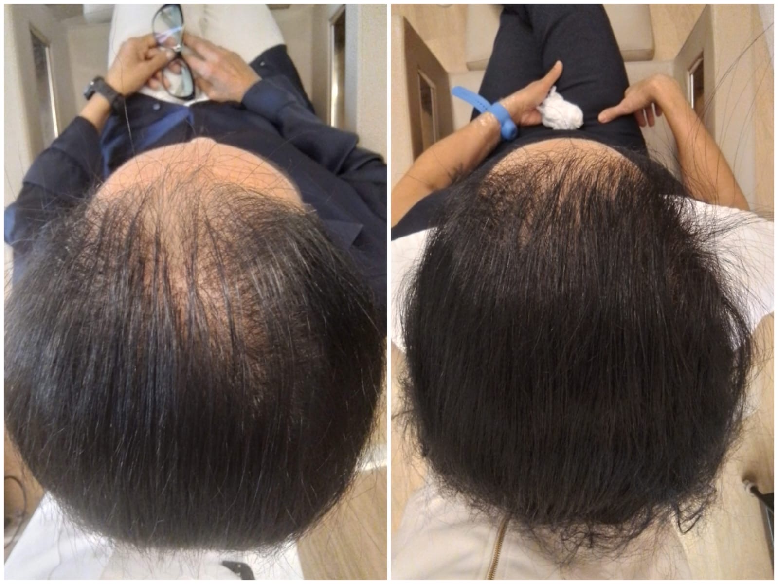Resultado capilar comparativo de antes e depois 7