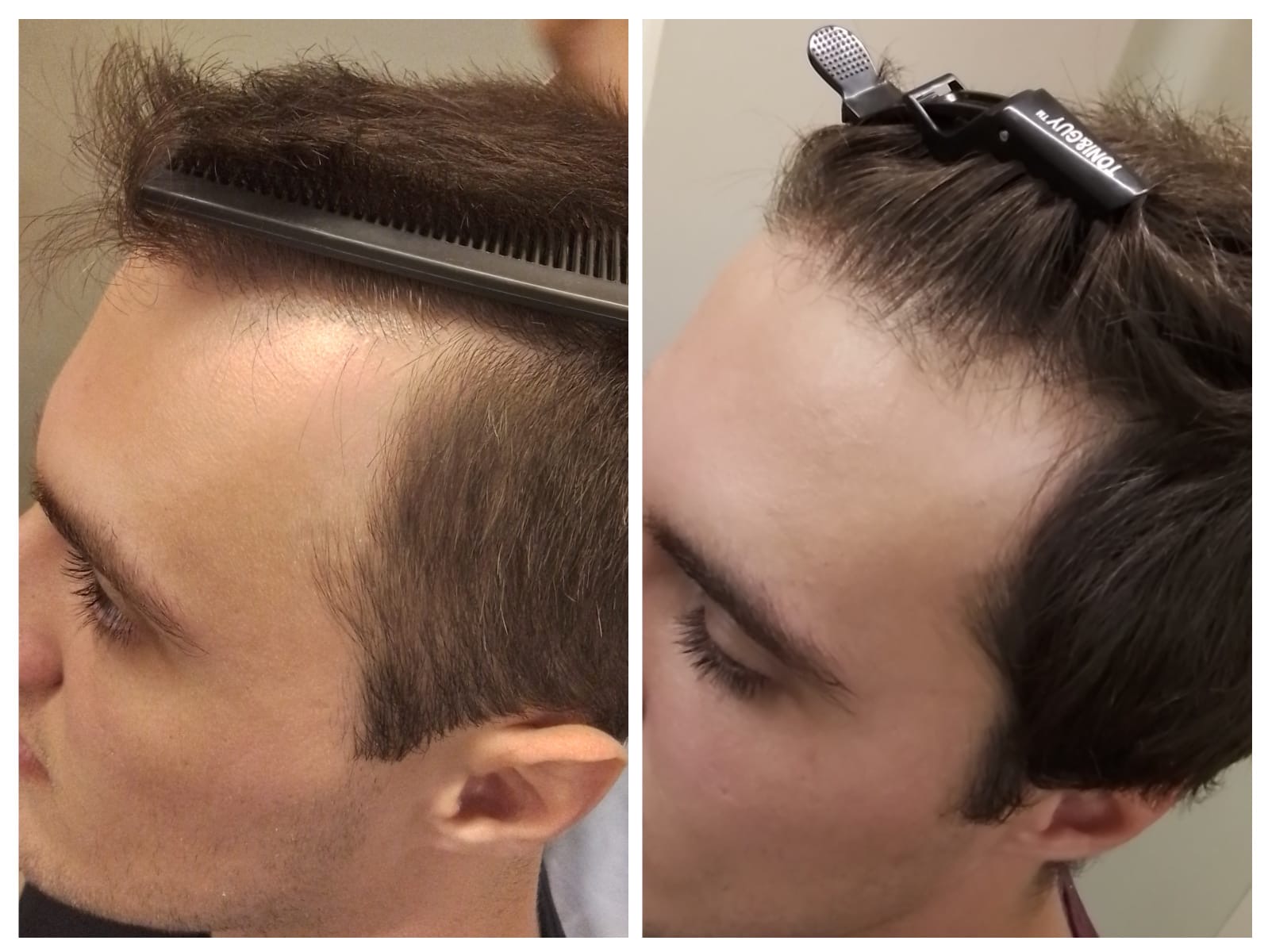 Resultado capilar comparativo de antes e depois 8